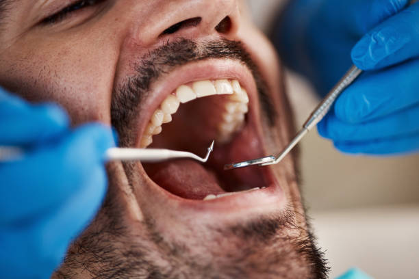 Best Chipped Tooth Repair Near Me  in Cleona, PA